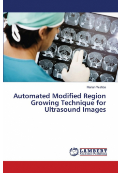 Automated Modified Region Growing Technique for Ultrasound Images