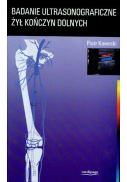 Badanie ultrasonograficzne żył kończyn dolnych