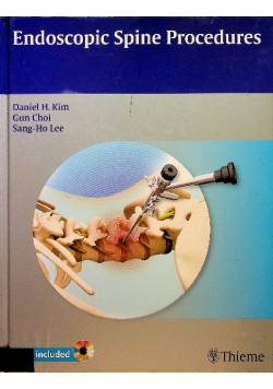 Endoscopic Spine Procedures