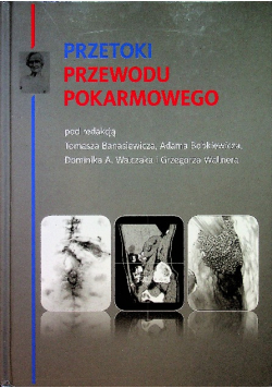 Przetoki przewodu pokarmowego
