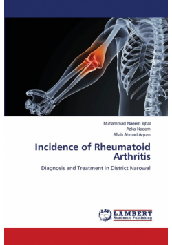 Incidence of Rheumatoid Arthritis
