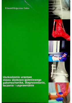 Uszkodzenia urazowe stawu skokowo goleniowego patomechanika diagnozowanie leczenie i usprawnienie