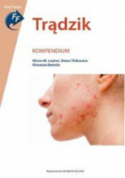 Trądzik. Kompendium