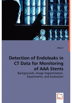 Detection of Endoleaks in CT Data for Monitoring of AAA Stents