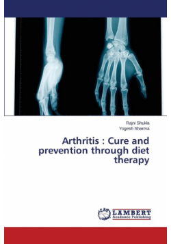 Arthritis